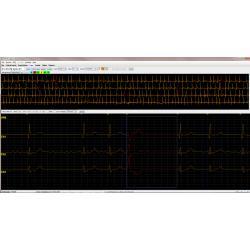 Holter LX Analysis (HE/LX) Software